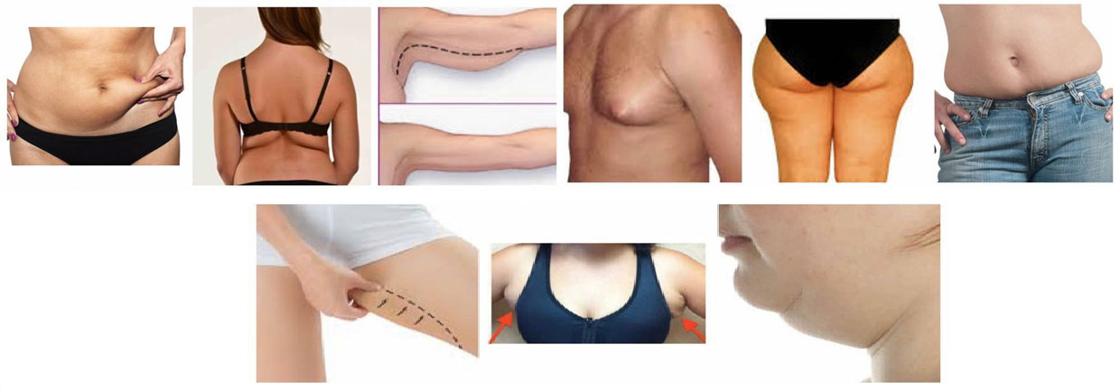 Psychological Kinesiology