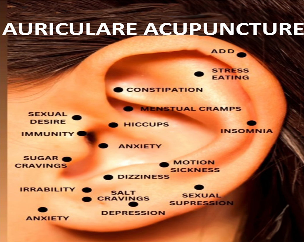 Auricular